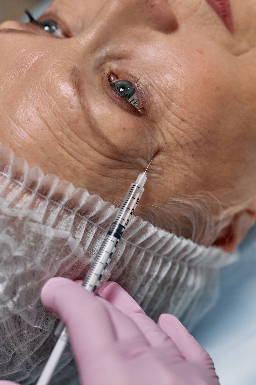 Toxina botulínica: qué es realmente la armonización facial con bótox